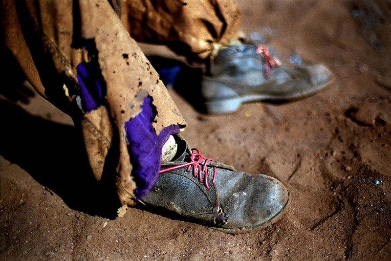 Tattered shoes and trousers