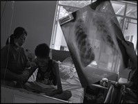 Airborne, A Struggle to Survive Tuberculosis