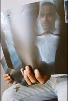 Mohamad with X-rays of his wounds, Zaoutar, Lebanon